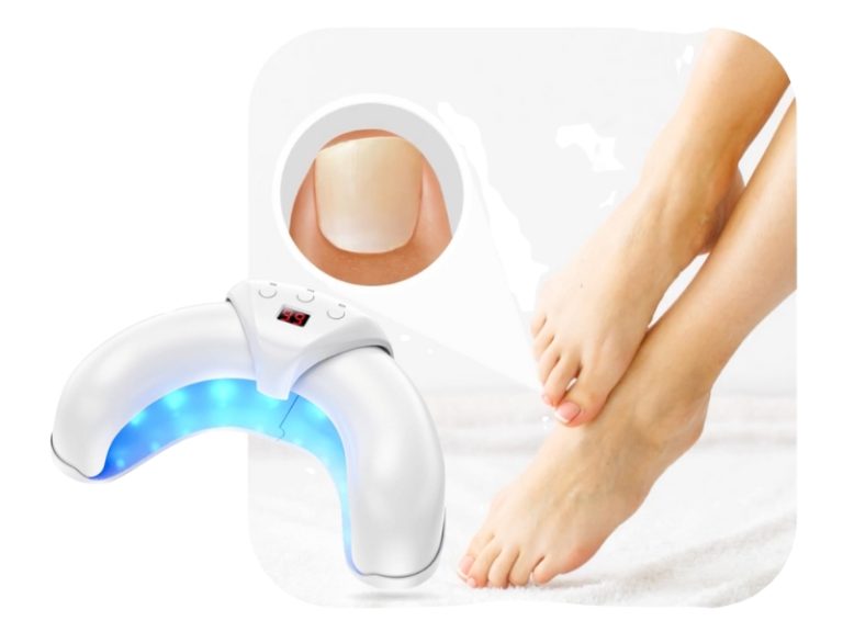 FungaBeam Reviews Advanced At-Home Nail Fungus LLLT Device Toenail Health